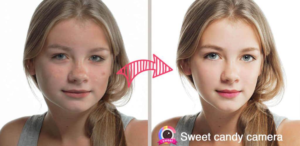 Sweet Candy Cam v4.8.1717 APK + MOD (Premium Unlocked)